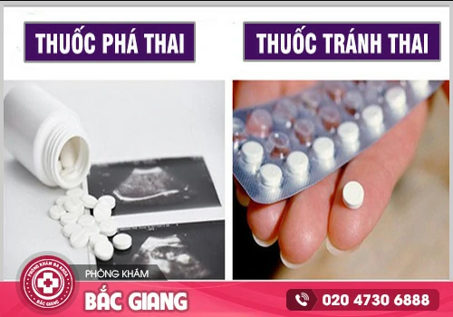 Có thuốc phá thai cấp tốc không?