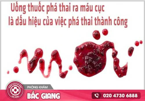 Chuyên gia giải đáp Uống thuốc phá thai bao lâu thì ra máu?